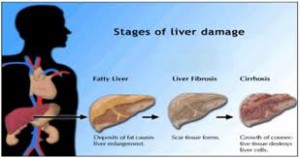 LIVER